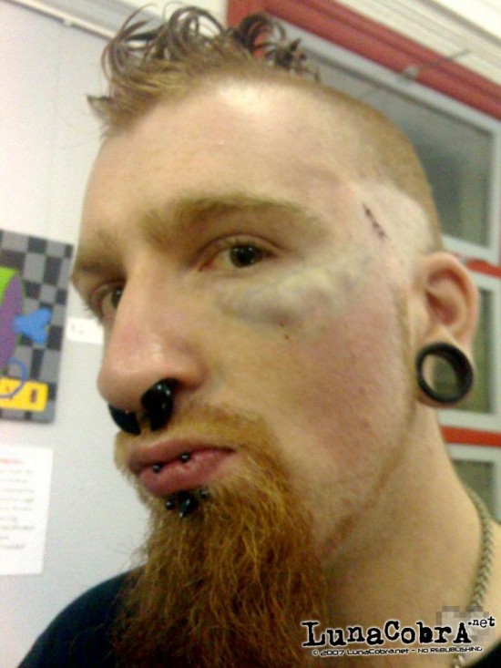S/W Ver: 85.97.70R Anti-Eyebrow Implants