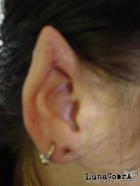 Ear Pointing Ear Pointing
