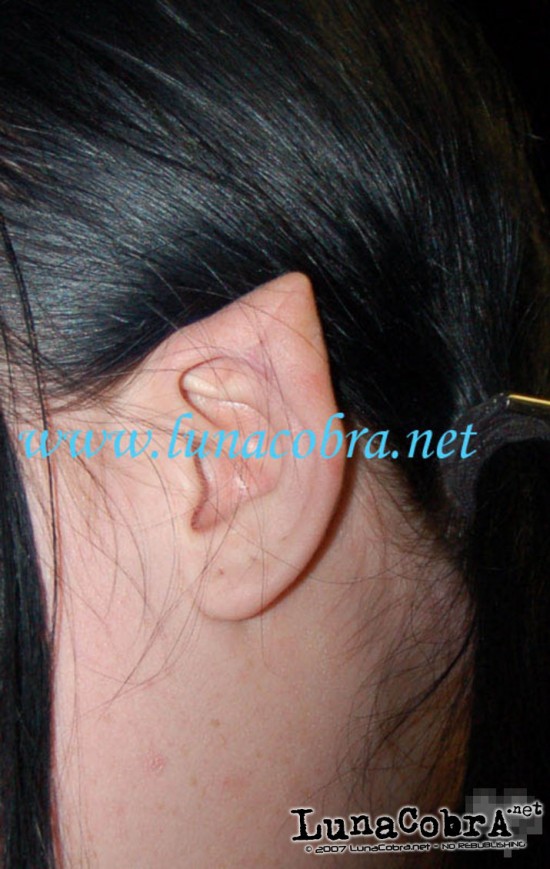 Ear Pointing Ear Pointing