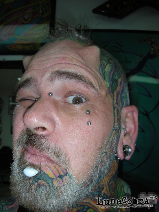 Hornz Implants Hornz Implants