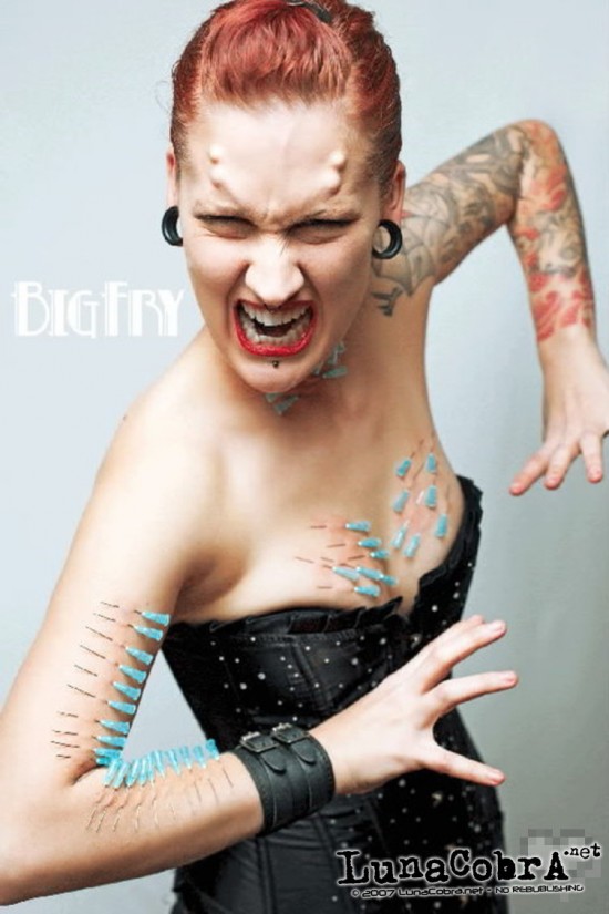 Implants Implants