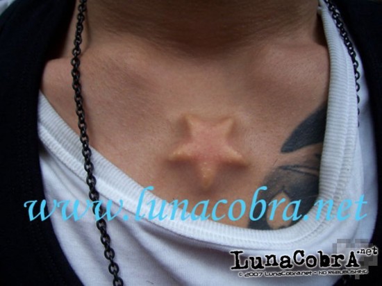 Implants Star Implants Star