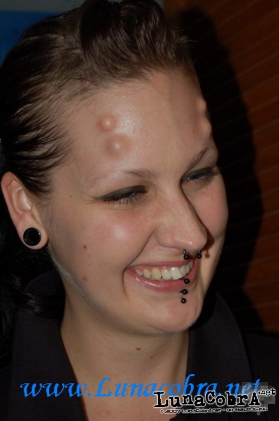 Implants Implants