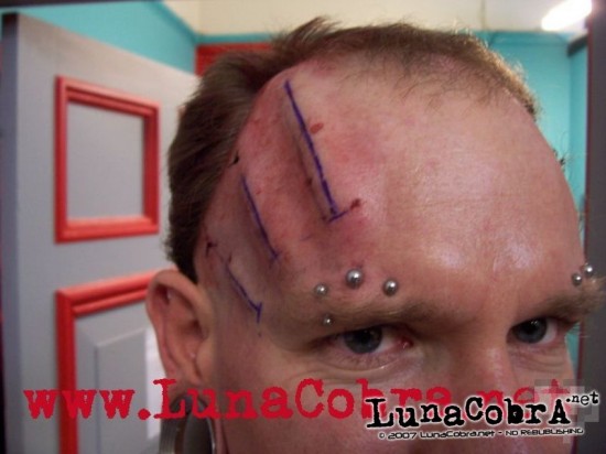 Jake forehead ridges Jake forehead ridges