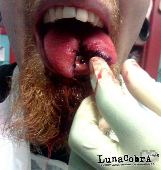 Tongue Splitting Tongue Splitting