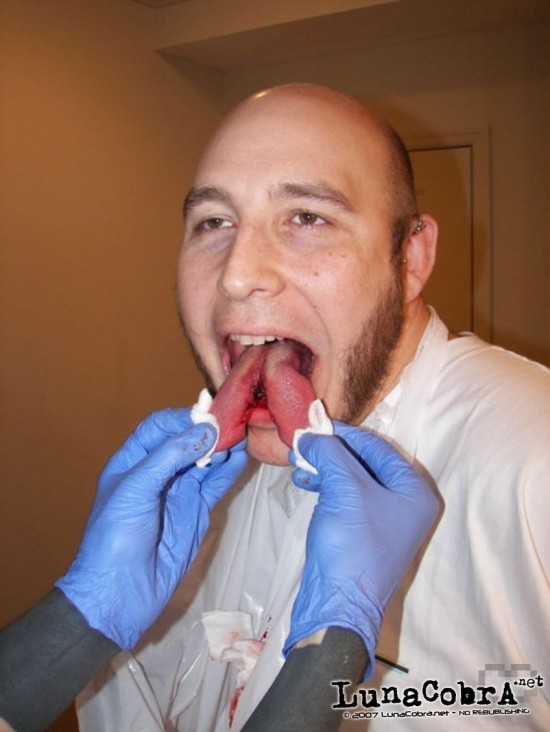 Tongue Splitting Tongue Splitting