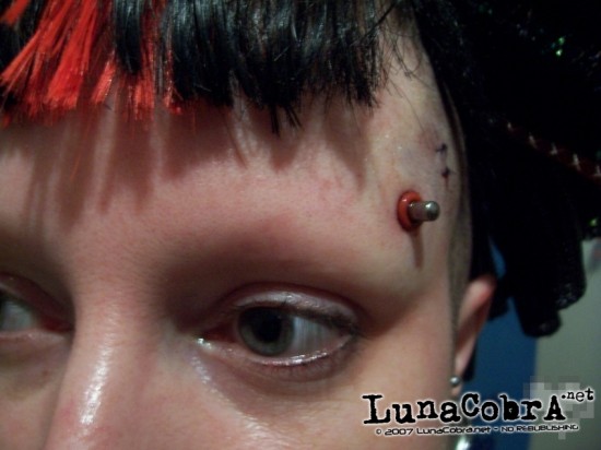 Transdermals Transdermals