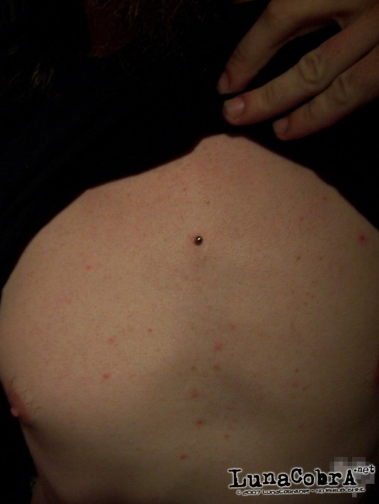 Transdermals Transdermals