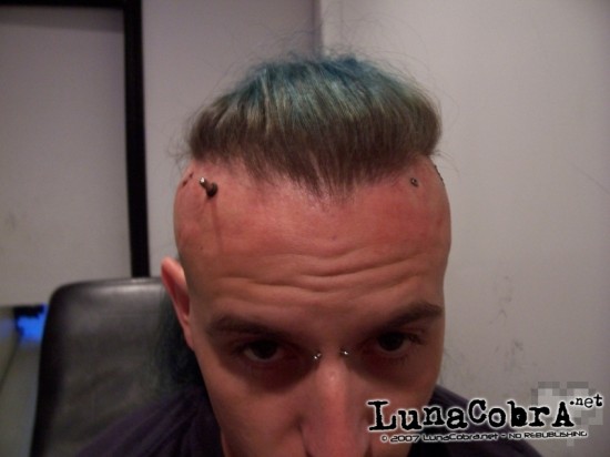 Transdermals Transdermals