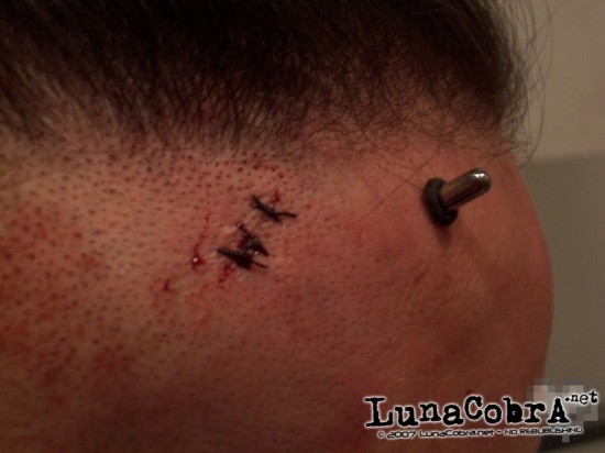 Transdermals Transdermals