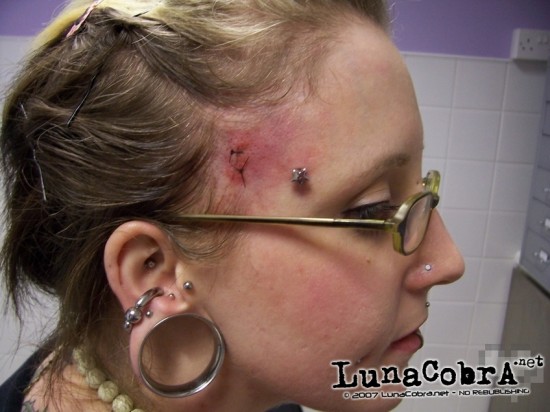 Transdermals Transdermals
