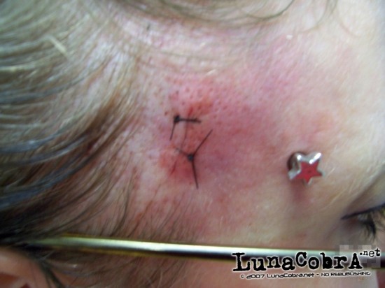 Transdermals Transdermals