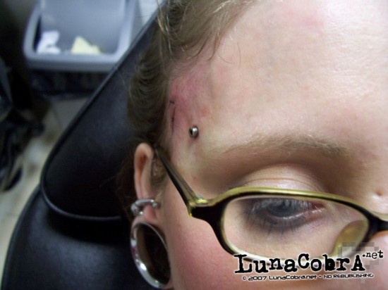 Transdermals Transdermals