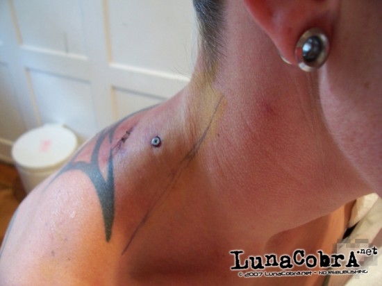 Transdermals Transdermals