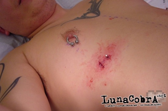 Transdermals Transdermals