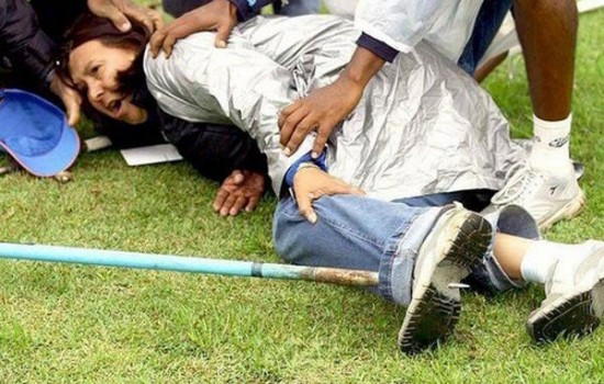 Worst Sports Injuries Worst Sports Injuries