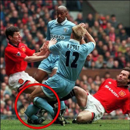 Worst Sports Injuries Worst Sports Injuries