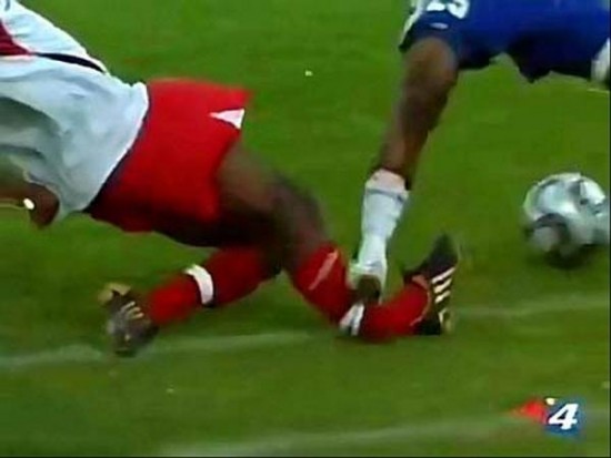 Worst Sports Injuries Worst Sports Injuries