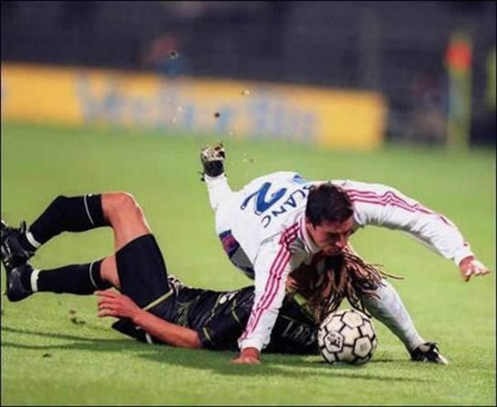 Worst Sports Injuries Worst Sports Injuries